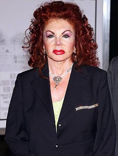 Миссис Сталлоне переборщила с пластикой