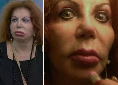 Миссис Сталлоне переборщила с пластикой