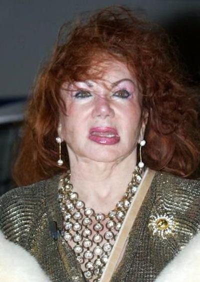 Миссис Сталлоне переборщила с пластикой