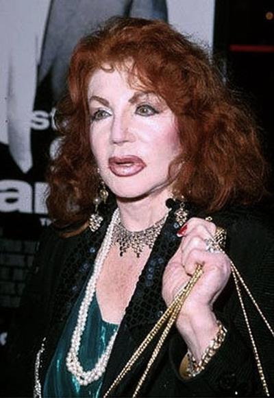 Миссис Сталлоне переборщила с пластикой