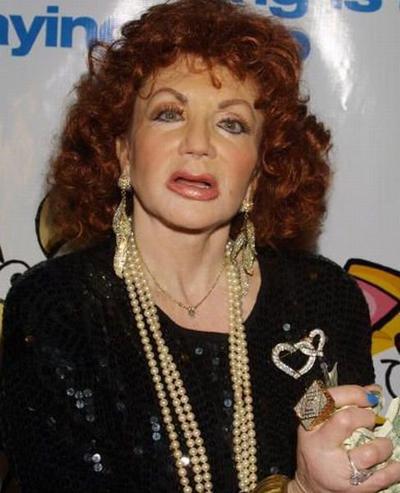 Миссис Сталлоне переборщила с пластикой