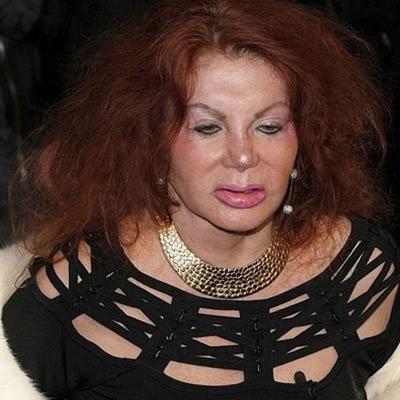 Миссис Сталлоне переборщила с пластикой