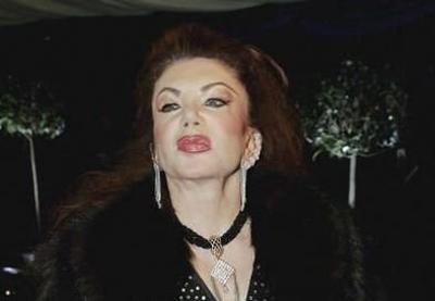 Миссис Сталлоне переборщила с пластикой