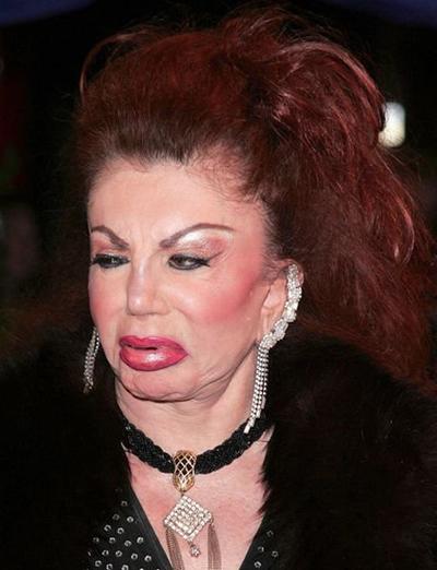 Миссис Сталлоне переборщила с пластикой