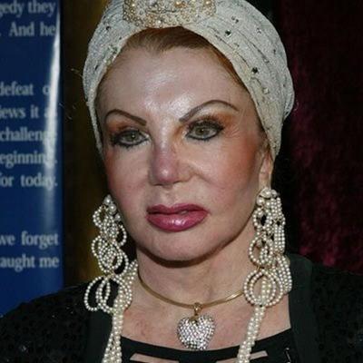 Миссис Сталлоне переборщила с пластикой