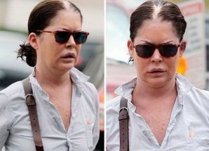 8 звезд кино, которые потеряли карьеру после пластических операций