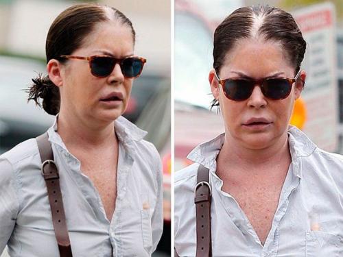 8 звезд кино, которые потеряли карьеру после пластических операций