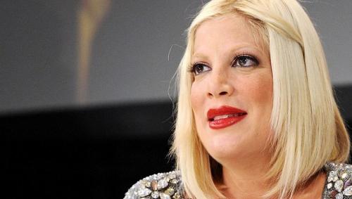 8 звезд кино, которые потеряли карьеру после пластических операций