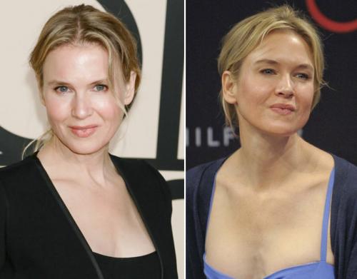 Неужели пластика? Подозрительно похорошевшие звезды