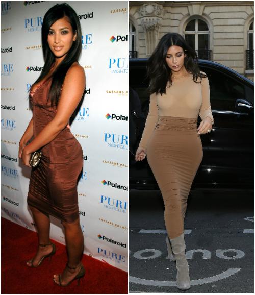 Неужели пластика? Подозрительно похорошевшие звезды