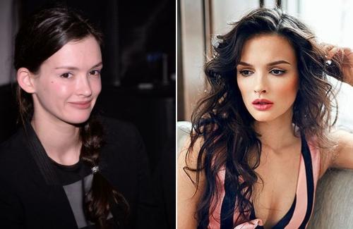 Неужели пластика? Подозрительно похорошевшие звезды