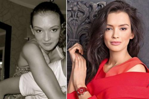 Неужели пластика? Подозрительно похорошевшие звезды