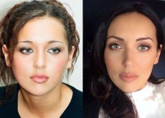 Неужели пластика? Подозрительно похорошевшие звезды