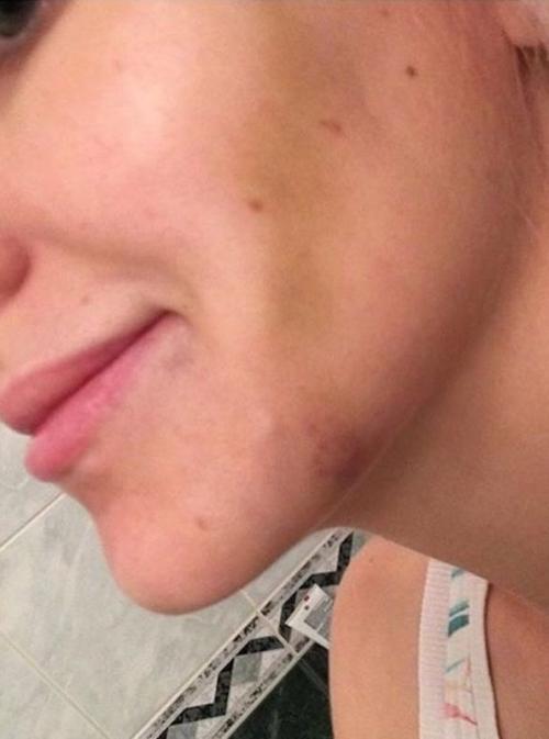 Неужели пластика? Подозрительно похорошевшие звезды