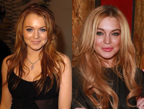 Неужели пластика? Подозрительно похорошевшие звезды