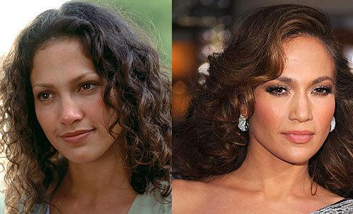 Неужели пластика? Подозрительно похорошевшие звезды