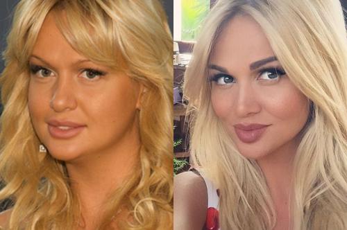 Неужели пластика? Подозрительно похорошевшие звезды