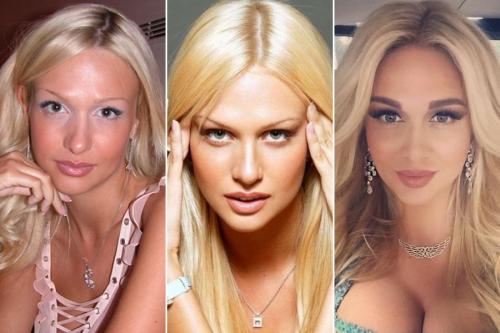 Неужели пластика? Подозрительно похорошевшие звезды