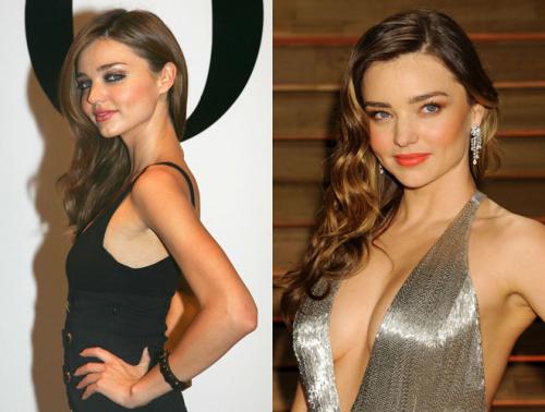 Неужели пластика? Подозрительно похорошевшие звезды