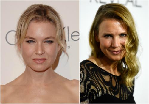 Неужели пластика? Подозрительно похорошевшие звезды