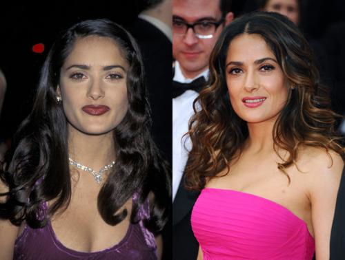 Неужели пластика? Подозрительно похорошевшие звезды