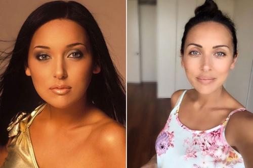 Неужели пластика? Подозрительно похорошевшие звезды