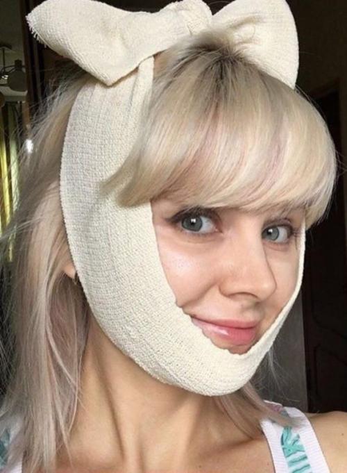 Неужели пластика? Подозрительно похорошевшие звезды