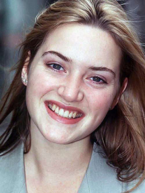 Неужели пластика? Подозрительно похорошевшие звезды