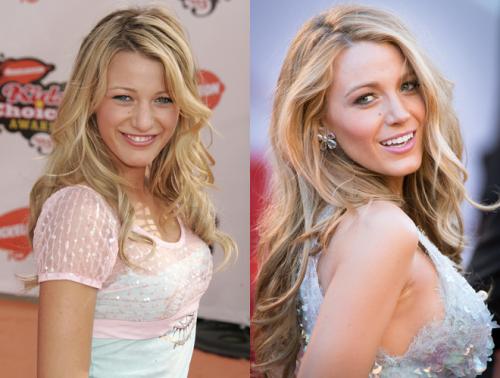 Неужели пластика? Подозрительно похорошевшие звезды