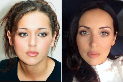 Неужели пластика? Подозрительно похорошевшие звезды