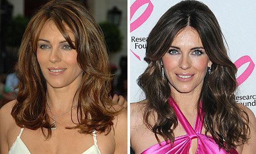 Неужели пластика? Подозрительно похорошевшие звезды