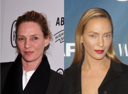 Неужели пластика? Подозрительно похорошевшие звезды