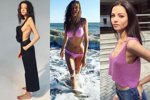 Неужели пластика? Подозрительно похорошевшие звезды