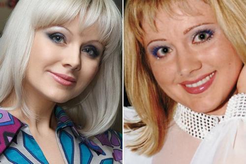 Неужели пластика? Подозрительно похорошевшие звезды