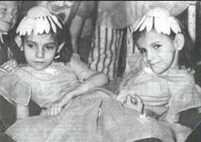 Самые известные сиамские близнецы в мире