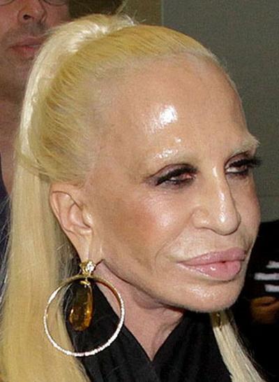 Знаменитые красавицы, которые потеряли привлекательность