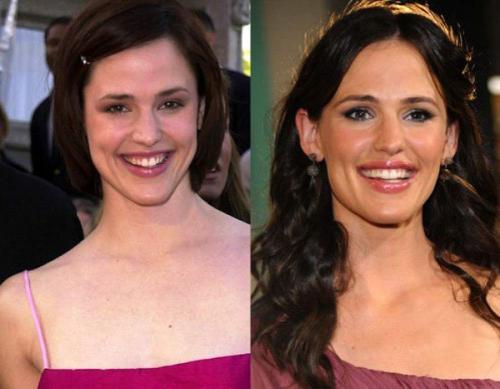 Как изменились 12 топовых зарубежных звезд за последние 15 лет