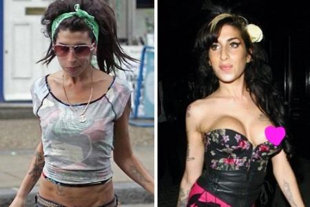 Самый выдающийся тюнинг груди: до и после