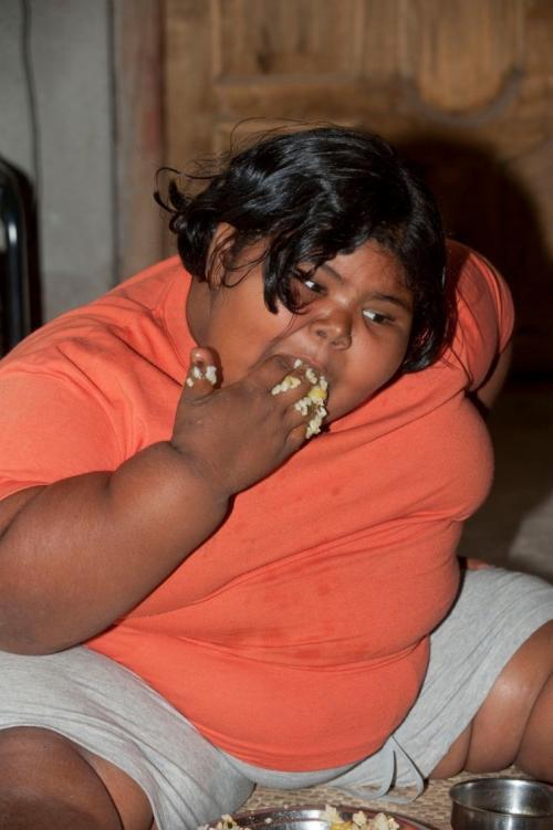 Девятилетняя девочка с неуемным аппетитом весит 92 килограмма