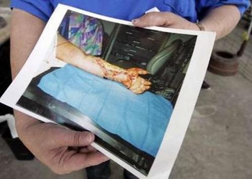 Змеиный человек держит змей у сердца