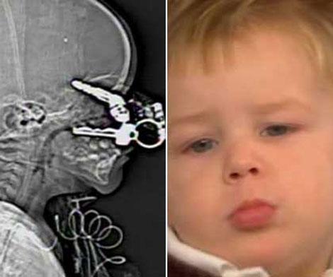 15 самых удивительных случаев исцеления в медицине