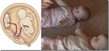 15 самых удивительных случаев исцеления в медицине