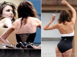 У Миранды Керр выступили кости