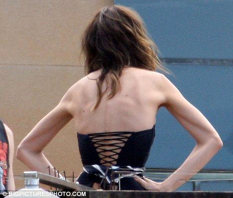 У Миранды Керр выступили кости