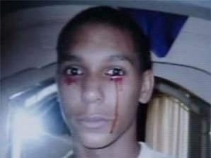 Тинейджер плачет кровавыми слезами