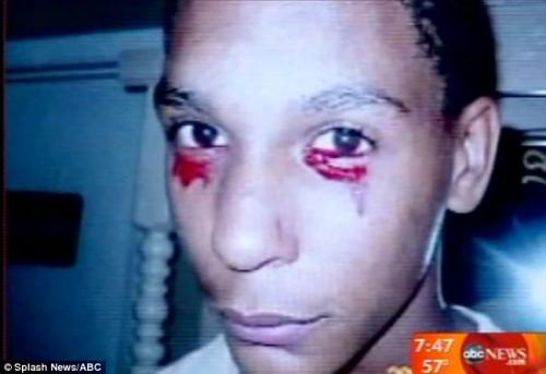 Тинейджер плачет кровавыми слезами