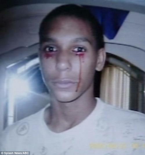 Тинейджер плачет кровавыми слезами