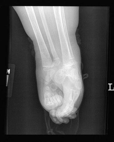 Девочка-русалка осталась с "хвостом"