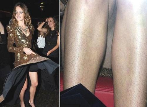 Летние промахи знаменитостей, которые не остались без внимания