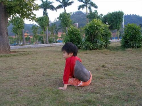 У китайского мальчика на спине вырос мех